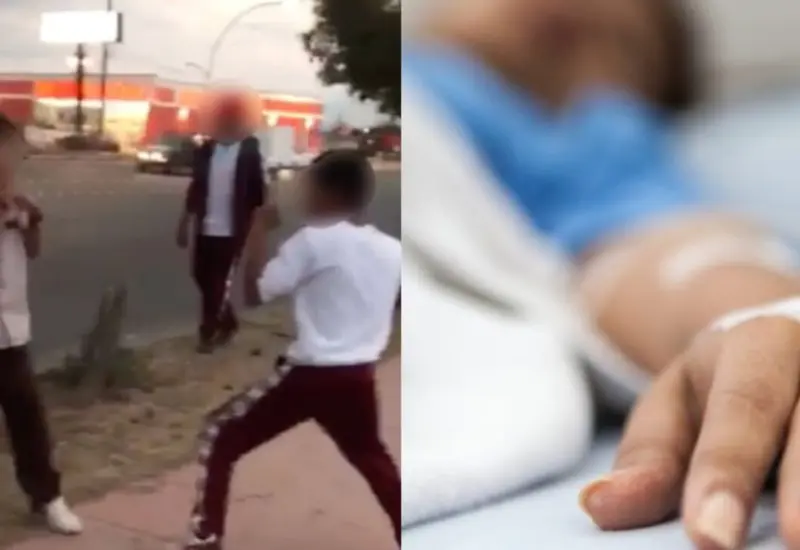Niño lesionado