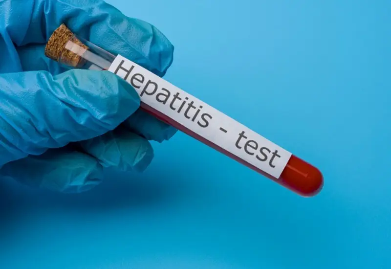 test_hepatitis