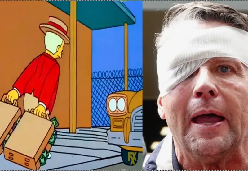 Alfredo Adame fue intervenido quirúrgicamente hace un mes y logró una muy buena recuperación de su ojo.