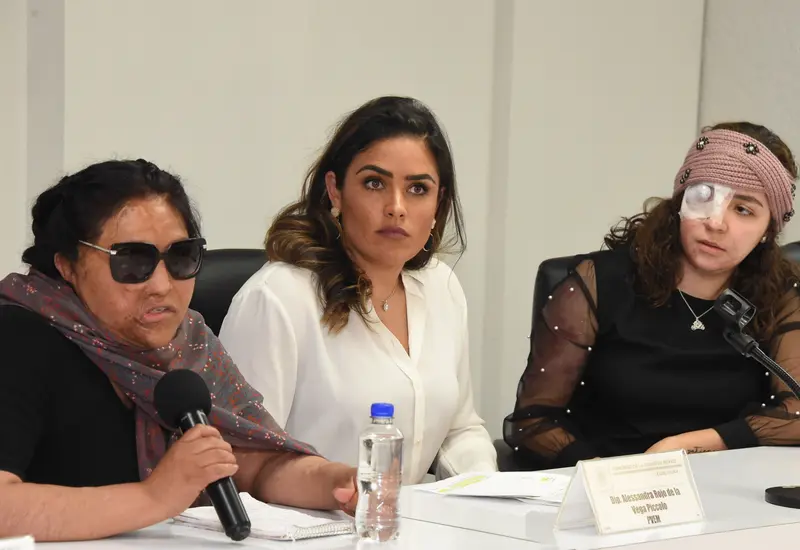 Fundación “Carmen Sánchez” revela que en la actualidad contabilizan a 34 mujeres sobrevivientes de ataques con ácido o sustancias corrosivas, en el país.