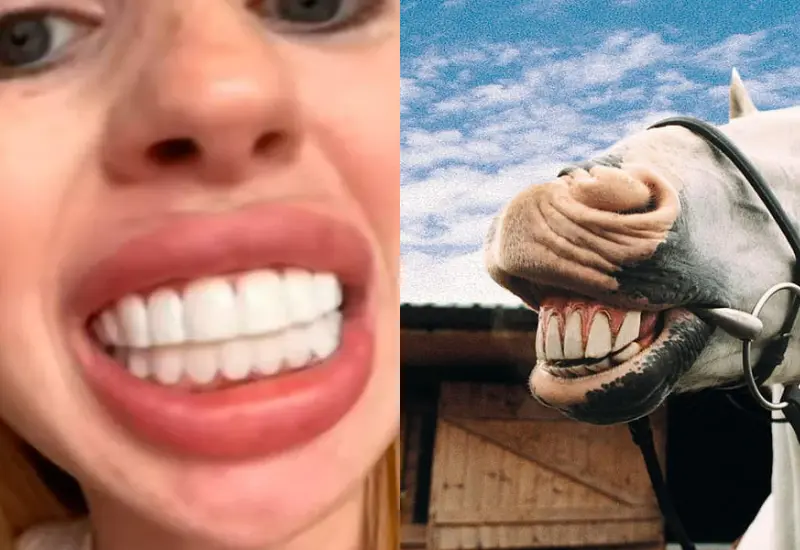 mujer-carillas-caballo-comparacion