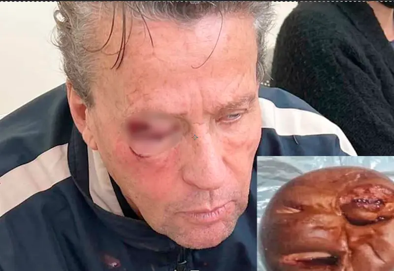 pan_alfredo_adame_ golpeado