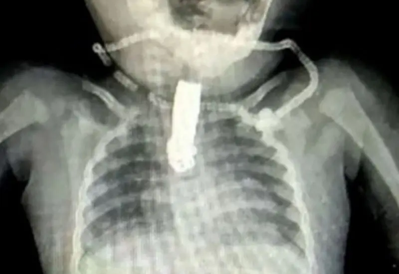 radiografia