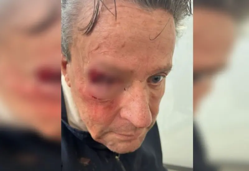 Nueva golpiza a Alfredo Adame