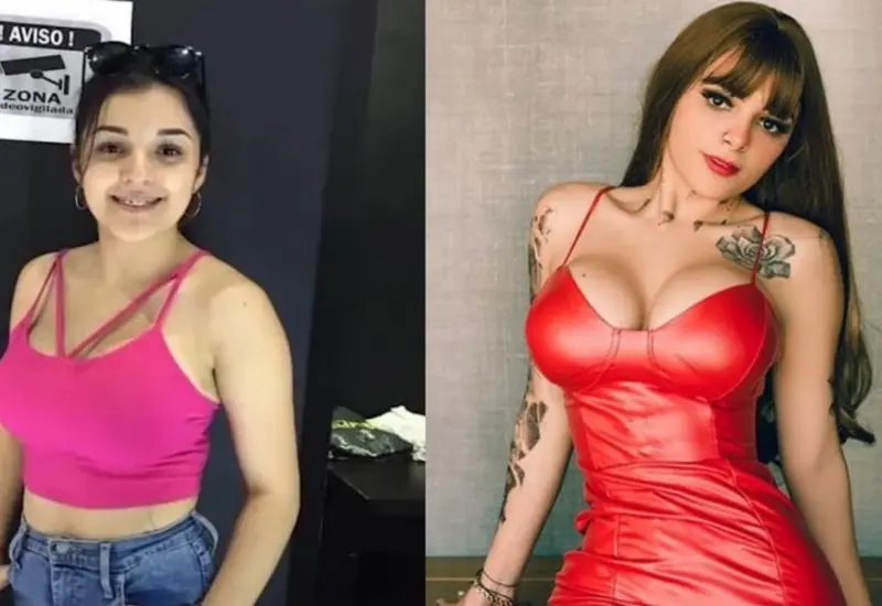 Cirugías estéticas de Karely Ruiz 