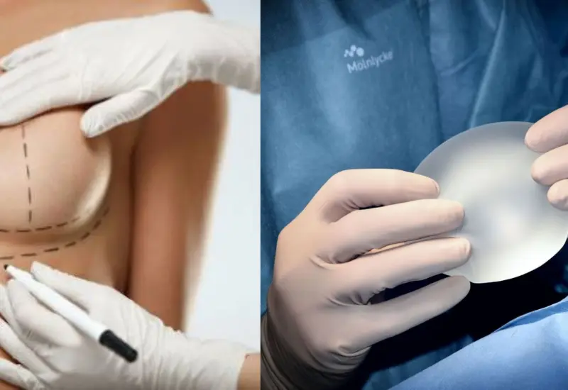 implantes-senos