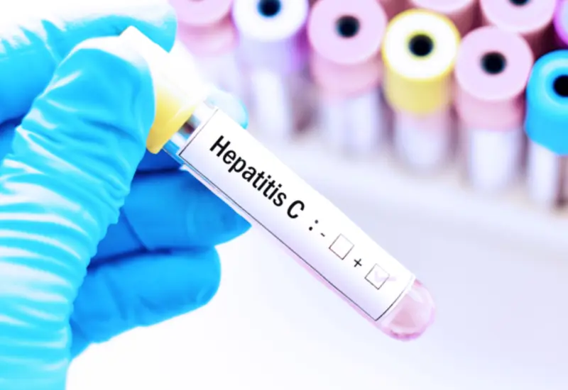 hepatitis-oaxaca