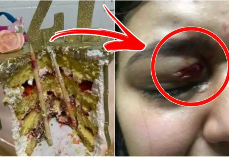 cumpleañera_casi_pierde_ojo