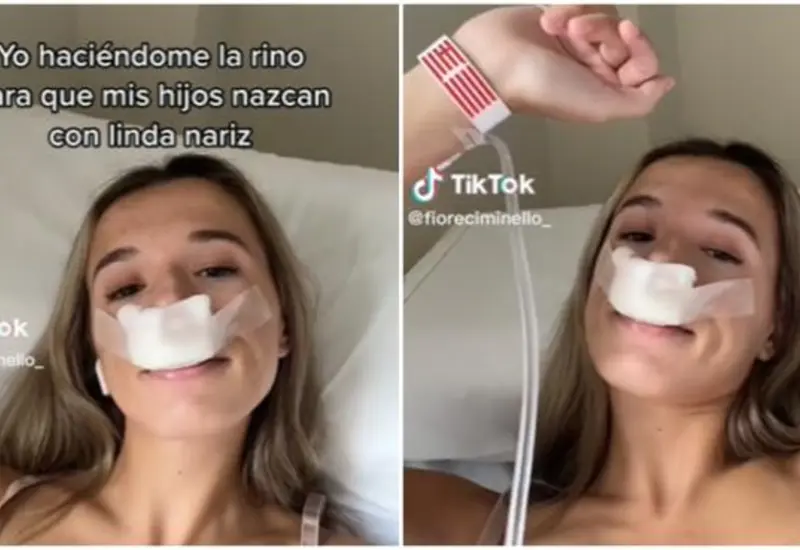 se_hace_la_rino_para_heredar_nariz_bonita
