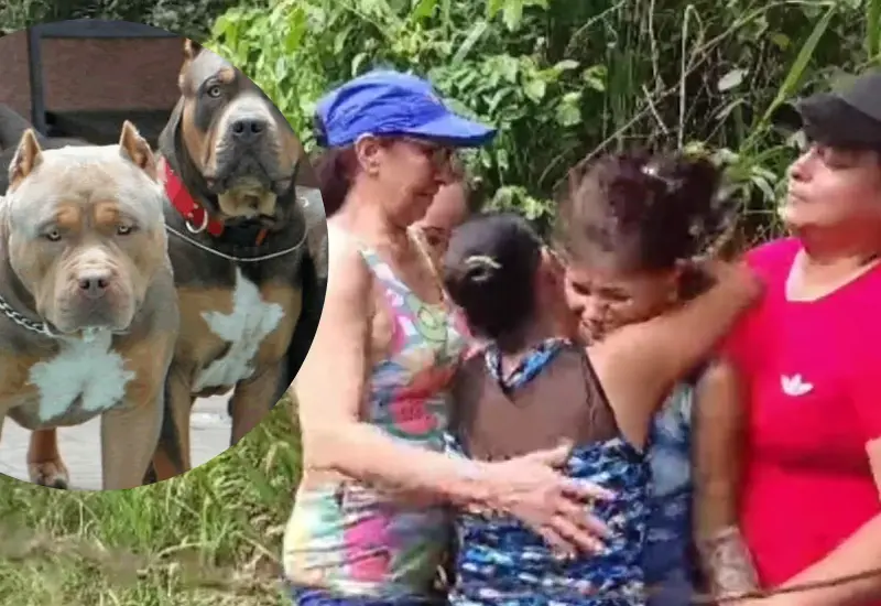 pitbull-ataque-niño