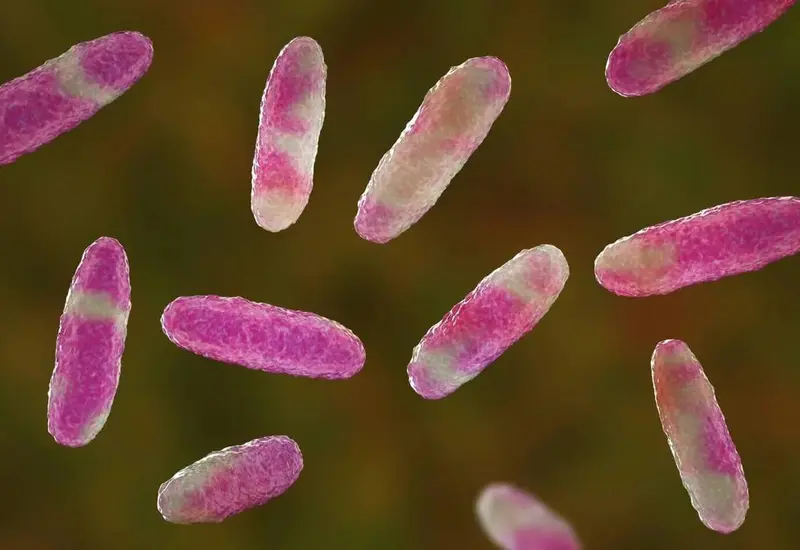 Klebsiella-oxytoca-bacteria