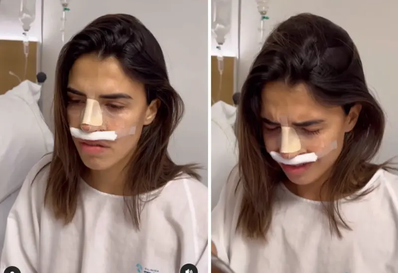influencer_se_queja_de_rinoplastia