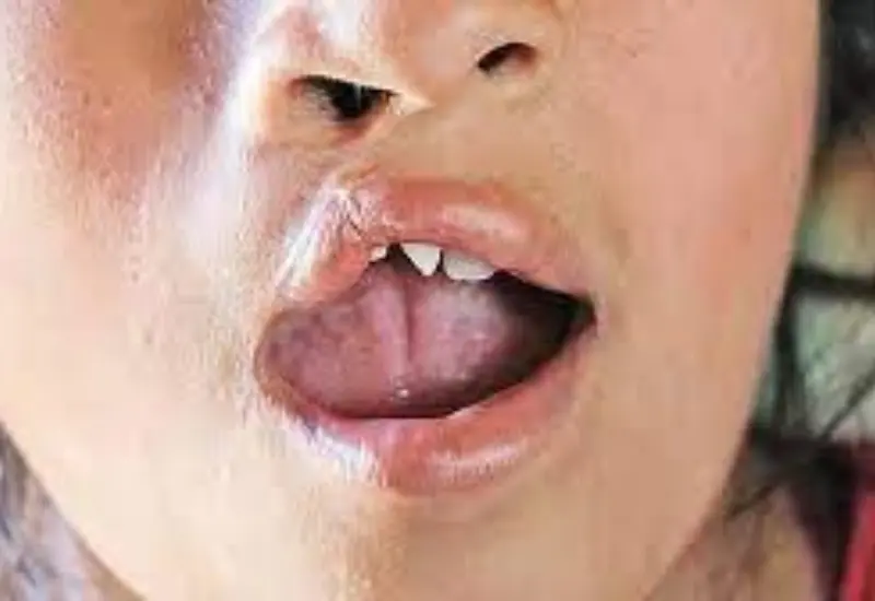 labios-oaxaca