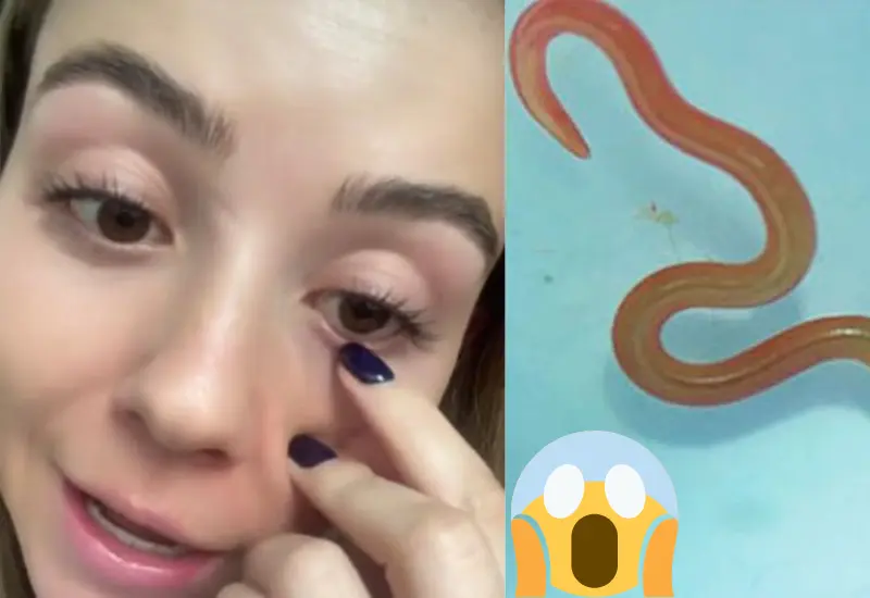mujer_tenia_gusano_en_ojo