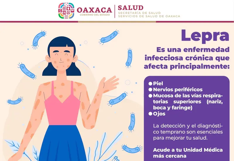 salud-oaxaca