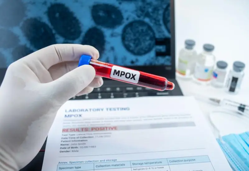 Mpox