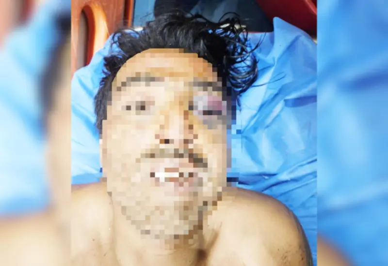 Hombre es encontrado inconsciente y con diferentes lesiones.