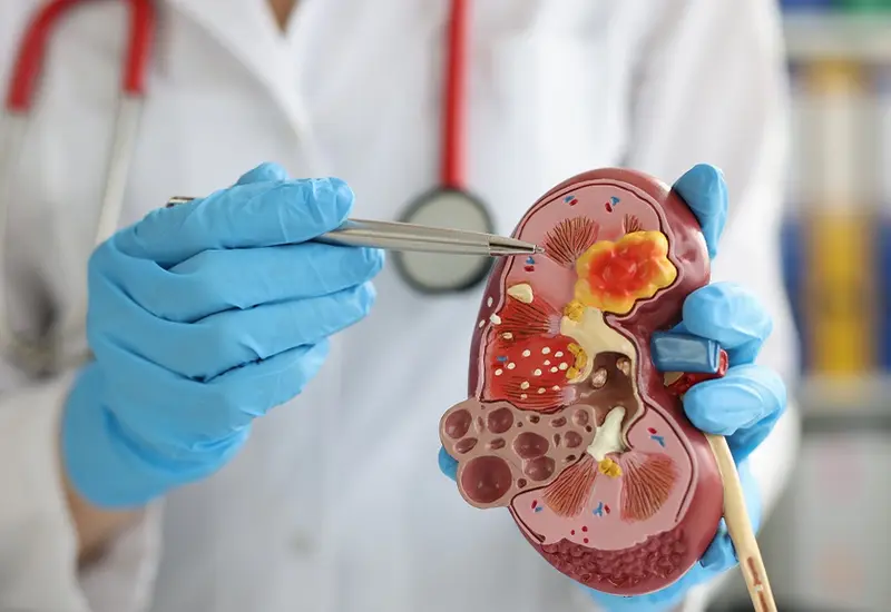 Los riñones cumplen con la función renal de filtrar  la sangre, eliminar desechos y mantener el equilibrio de sustancias químicas en el cuerpo.