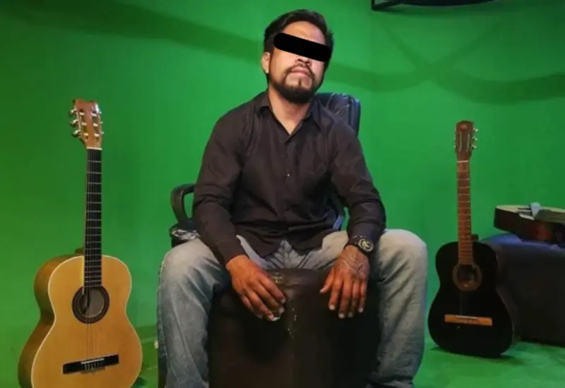Diego necesita una reconstrucción completa del rostro.
