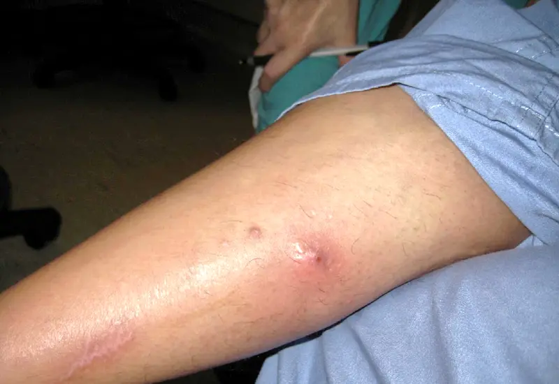 gusano_barrenador_recoemendaciones