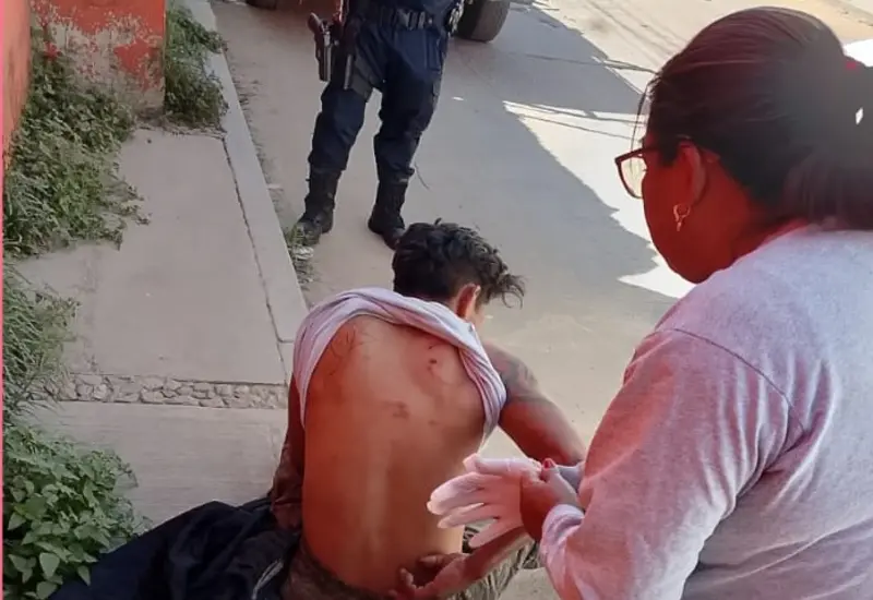 Jesús Ángel, un hombre que muestra las heridas tras ser golpeado por mototaxistas en la agencia municipal de San Martín Mexicápam.