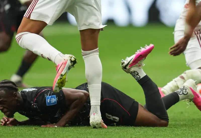 El canadiense Ismael Koné sufrió una fractura en la pierna izquierda.