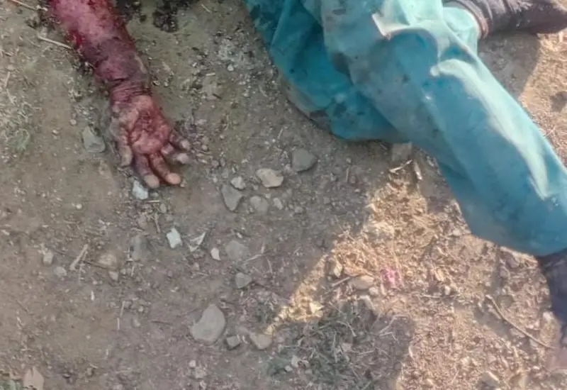 La mujer fue atendida por paramédicos