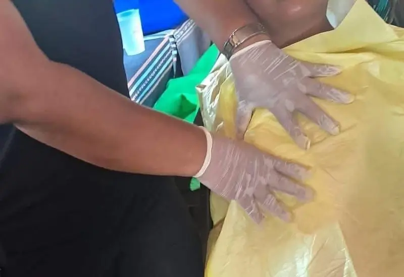 Niño de 11 años recibe atención tras picadura de medusa en Huatulco.