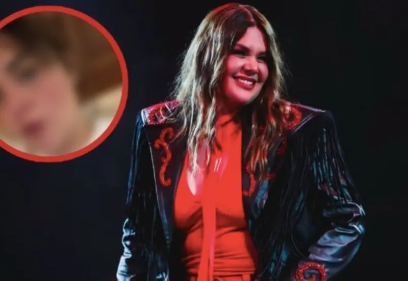 La cantante Yuridia muestra la quemadura que sufrió en su rostro como resultado de una reacción al aciclovir para tratar herpes.