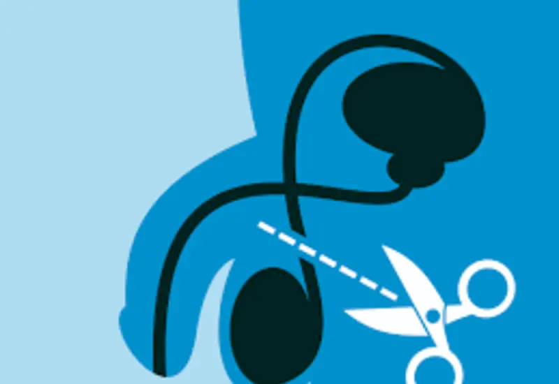 Cada viernes ofrecen vasectomías gratis en unidades médicas del estado.