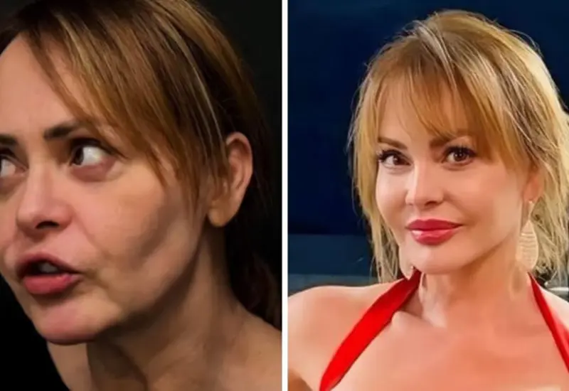 La actriz Gaby Spanic muestra su radical cambio físico después de someterse a una cirugía correctiva en Brasil.